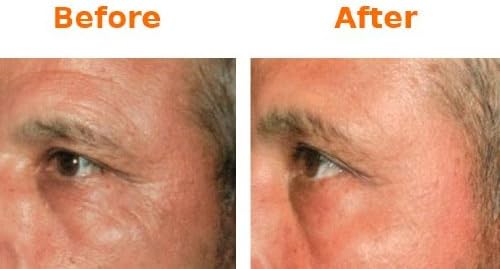 Amazing Skin Rejuvenation Products Seen on Tv Provide the Best Anti Aging Skin Care with Fast Results. Kit Contains Mask, Toner, and Moisturizer Designed to Work Together for Younger Looking Skin Guaranteed!