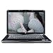Dell Inspiron i1545 Notebook PC (Red) - 15.6" Widescreen Display / Intel Pentium T4400 2.2GHz / 3GB DDR2 / 250GB HD / Built-in Webcam / DVD±RW/CD-RW Drive / 802.11b/g WLAN / Windows 7 Home Premium 64-bit image 3