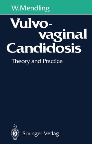 Vulvovaginal Candidosis: Theory and Practice