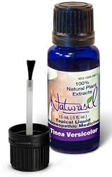 Tinea Versicolor Natural Treatment By Naturasil 15ml