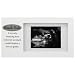 Malden Sneak Peek Sonogram Juvenile Frame, White