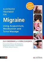 Illustrated Treatment for Migraine Using Acupuncture, Moxibustion and Tuina Massage: Treated With Acupuncture, Moxibustion and Tuina Massage Illustrated Treatment for Migraine Using Acupuncture, Moxibustion and Tuina Massage: Treated With Acupuncture, Moxibustion and Tuina Massage