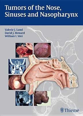 [(Tumors of the Nose, Sinuses, and Nasopharynx)] [Author: Valerie J. Lund] published on (April, 2014), by Valerie J. Lund