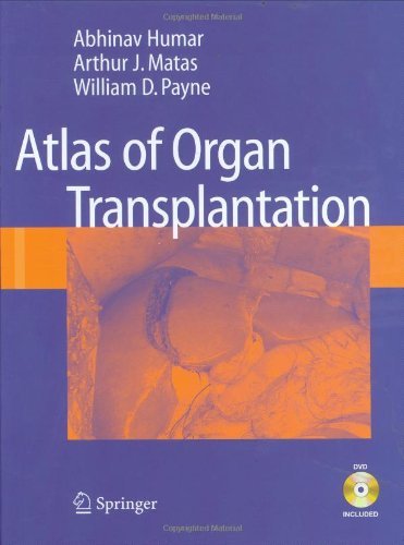 Atlas of Organ Transplantation, by Abhinav Humar, Arthur J. Matas, William D. Payne Atlas of Organ Transplantation, by Abhinav Humar, Arthur J. Matas, William D. Payne
