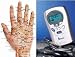 Alexander Innovation Wizard TH366 Aculife Magnetic Wave Therapist