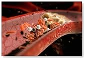 Quick Tips for Lowering Cholesterol and Triglycerides
