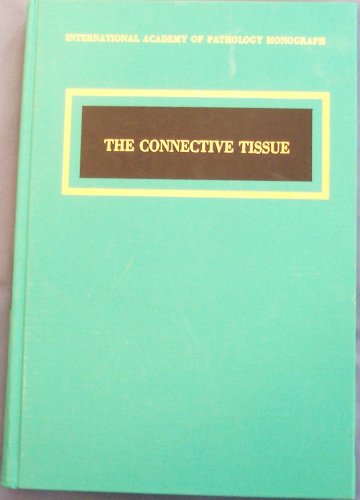 Connective-Tissue-Disorders