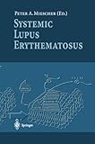 Systemic lupus erythematosus