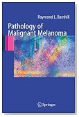 Pathology of Malignant Melanoma