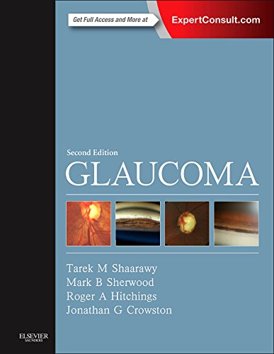 Glaucoma: 2-Volume Set, 2e