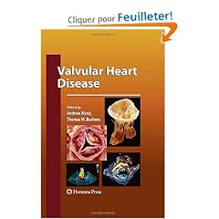 Valvular Heart Disease