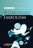 Pulmonary Embolism
