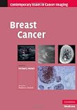 Breast Cancer (Contemporary Issues in Cancer Imaging)