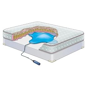 Contour Products Mattress Remedy