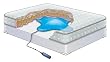 Mattress Remedy - Full/Queen Size
