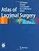 Atlas of Lacrimal Surgery