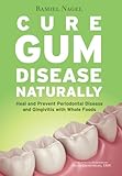 Cure Gum Disease Naturally: Heal and Prevent Periodontal Disease and Gingivitis with Whole Foods