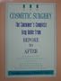 Cosmetic Surgery: the Consumer's Complete Easy Guide From Before to After