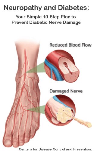 diabetes symptoms