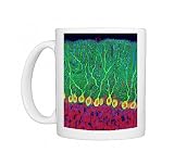 Purkinje nerve cells in the cerebellum Photo Mugs