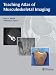 Book Teaching Atlas of Musculoskeletal Imaging (TEACHING ATLAS SERIES)