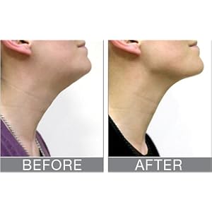 Rio 60 Second Neck Toner with EMS Technology