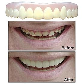 Natural Imako Cosmetic Teeth, size Large