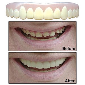 Natural Imako Cosmetic Teeth, size Small