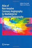 Atlas of Non-Invasive Coronary Angiography by Multidetector Computed Tomography (Developments in Cardiovascular Medicine)