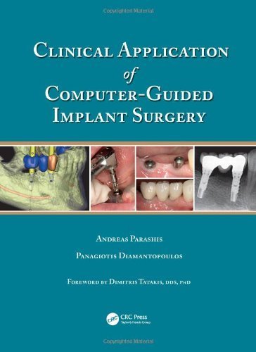 Clinical Application of Computer-Guided Implant Surgery by Andreas Parashis (2013-09-13)
