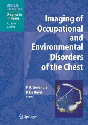 Imaging of Occupational and Environmental Disorders of the Chest ...