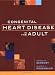 Congenital Heart Disease Adult