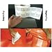 RV Camper Awning Canvas Cloth Tent Hole Repair Patch - Tear Aid 6" x 12" Patch A