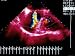 Patent Foramen Ovale Transesophageal Echocardio Photographic Poster Print, 16x12
