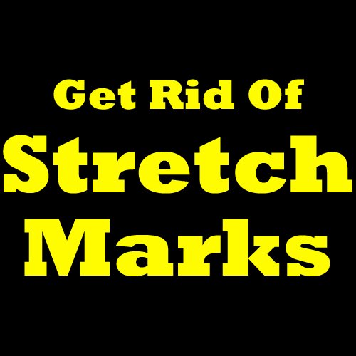 how to get rid of stretch marks