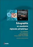 Echographie en anesthesie régionale périphérique (1DVD)
