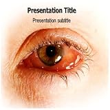 Eye Infection Powerpoint Templates - Eye Infection Powerpoint (PPT) Backgrounds Slides