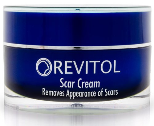 acne scar removal