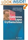 Cutaneous Lupus Erythematosus