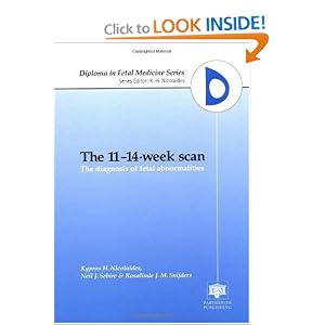 Click here to buy The 11-14-Week Scan: The Diagnosis of Fetal Abnormalities by R.J.M. Snijders.