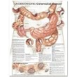 Chart - Understanding Colorectal Cancer