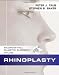 Rhinoplasty