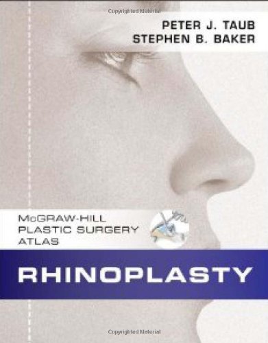 rhinoplasty surgery