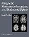 Magnetic Resonance Imaging  of the Brain and Spine