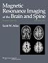 Magnetic Resonance Imaging  of the Brain and Spine