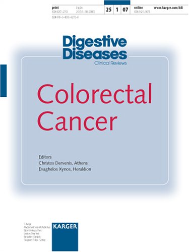 Colorectal-Cancer