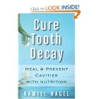 Cure Tooth Decay: Heal And Prevent Cavities With Nutrition by Ramiel Nagel