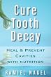 Cure Tooth Decay: Heal And Prevent Cavities With Nutrition