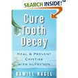 Cure Tooth Decay: Heal and Prevent Cavities with Nutrition by  Ramiel Nagel