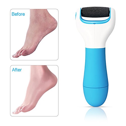 BESTOPE Electric Pedicure Callus Remover Perfect Foot File for Remove
